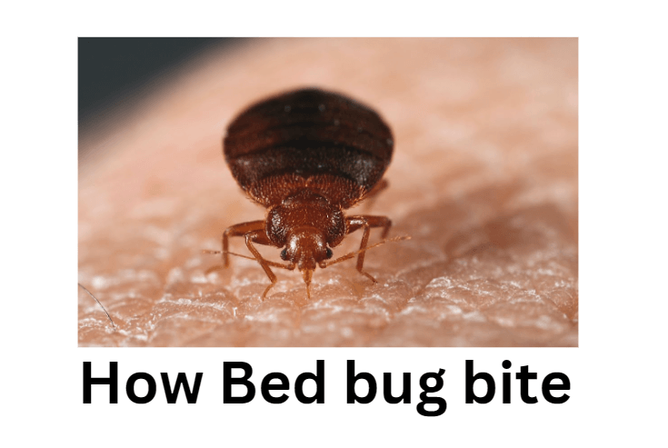 How Bed bug bite